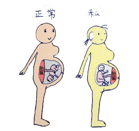 PLACENTA2.jpg